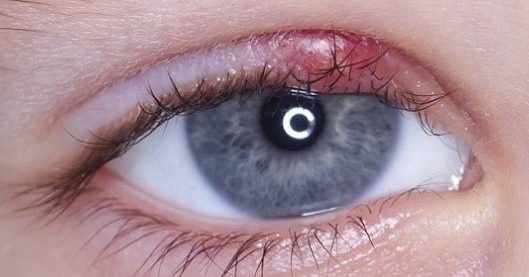 Нужен ли врач