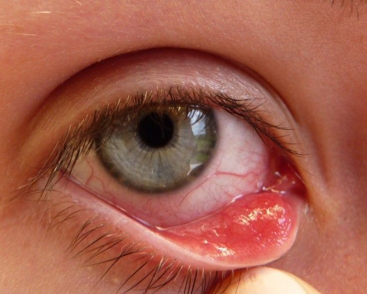 Причины зуда