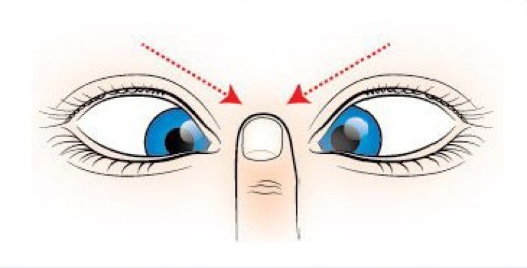 гимнастика