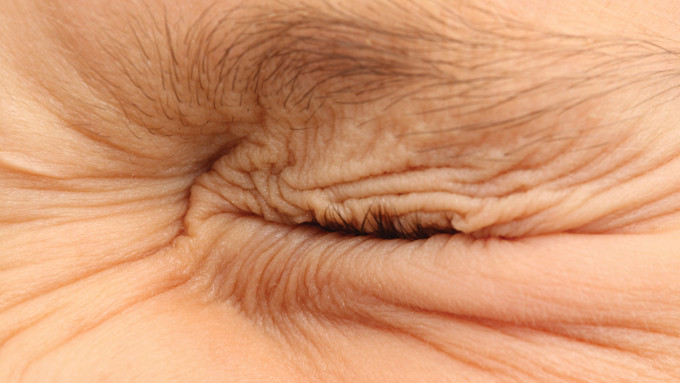 Что такое блефароспазм