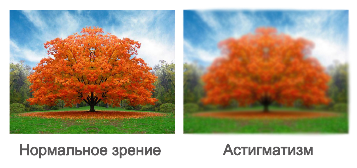 Как видят люди с астигматизмом